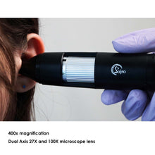 Load image into Gallery viewer, Oto-Dermascope: Advanced Digital Otoscope & Dermascope for Medical Professionals with image capturing and video recording