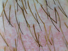 Load image into Gallery viewer, Digital Wireless Dermascope