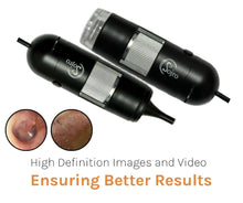 Load image into Gallery viewer, Oto-Dermascope: Advanced Digital Otoscope &amp; Dermascope for Medical Professionals with image capturing and video recording
