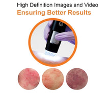 Load image into Gallery viewer, Oto-Dermascope: Advanced Digital Otoscope &amp; Dermascope for Medical Professionals with image capturing and video recording
